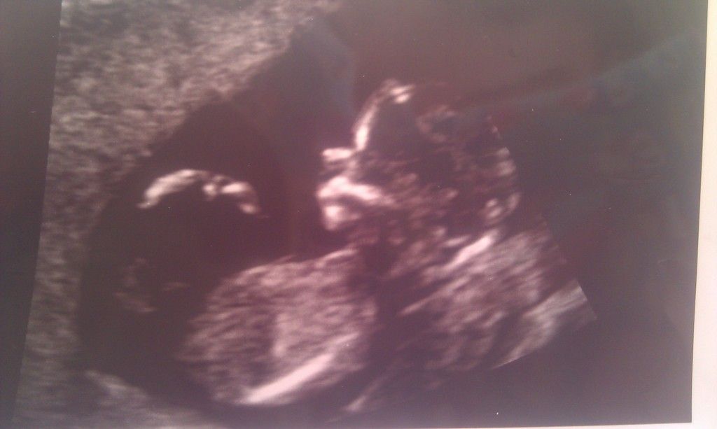 13 Week Potty Shot UPDATED BabyCenter